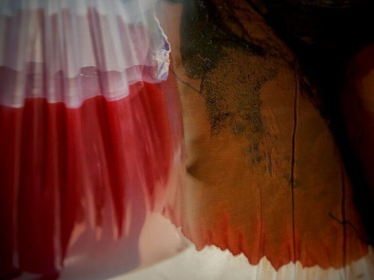 5 complicações da Transfusão Maciça