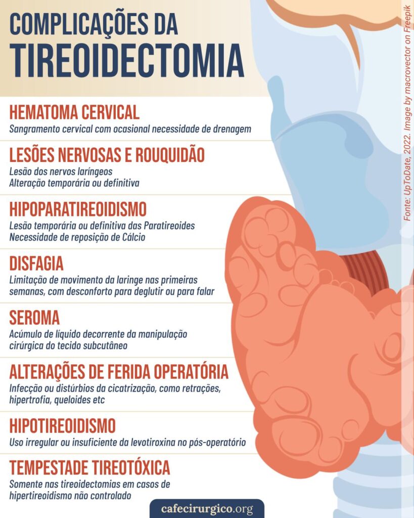 10 Complicações da Tireoidectomia O que pode dar errado na Cirurgia de