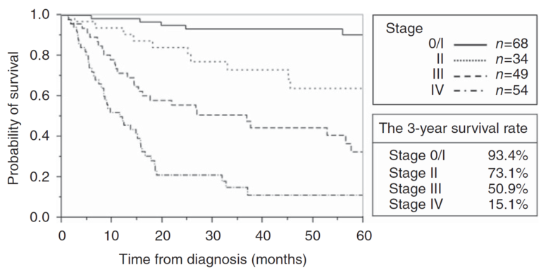 Câncer de Intestino Delgado: Como estadiar pelo TNM?