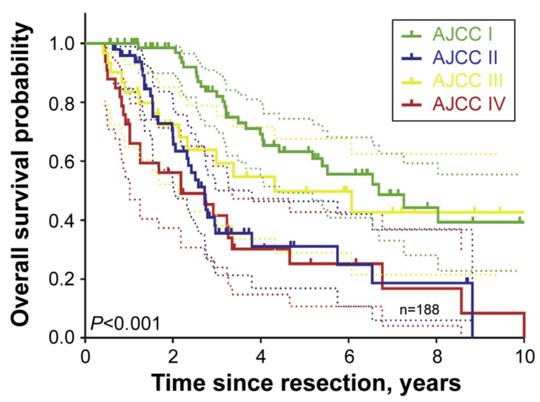 Colangiocarcinoma Intra-hepático